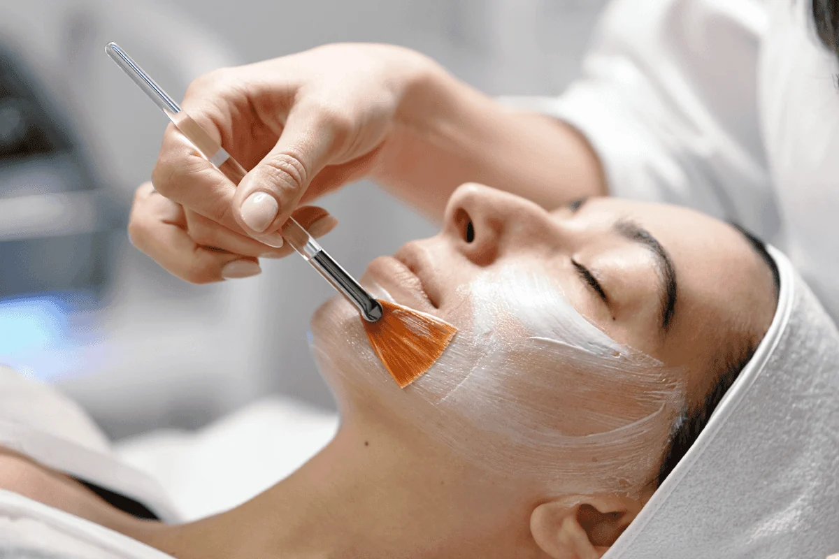 Aplicación de tratamiento pelling químico en cara de mujer